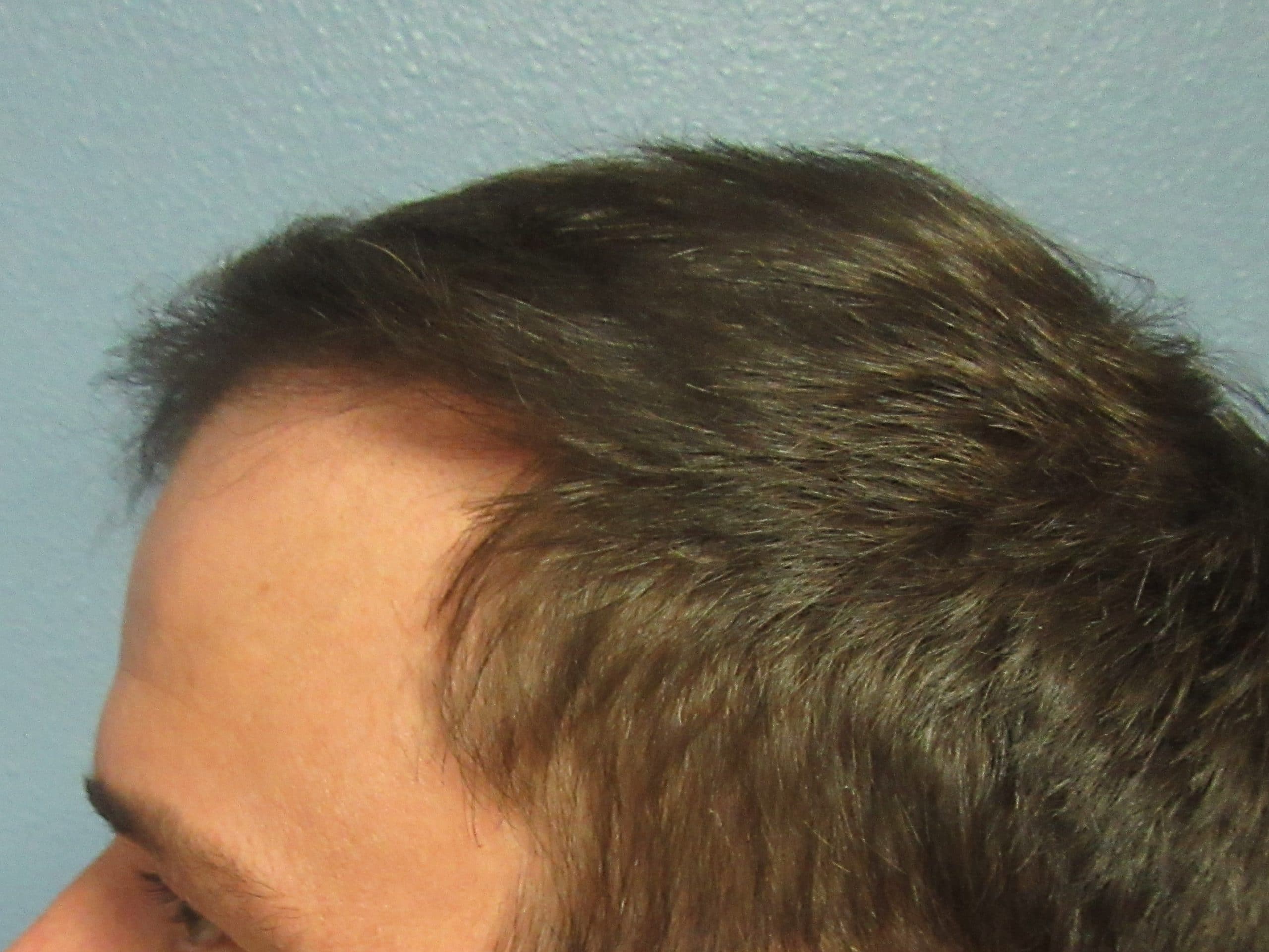 After Image